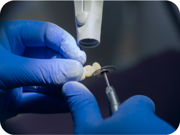 Imagen de ejemplo donde se muestran moldes de dentaduras