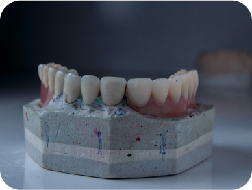 Imagen de ejemplo donde se muestran moldes de dentaduras